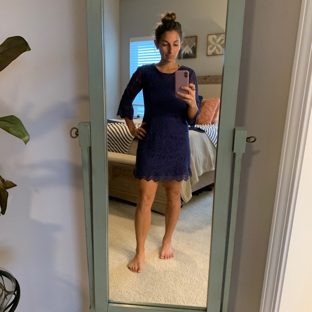 Mini Lace Dress